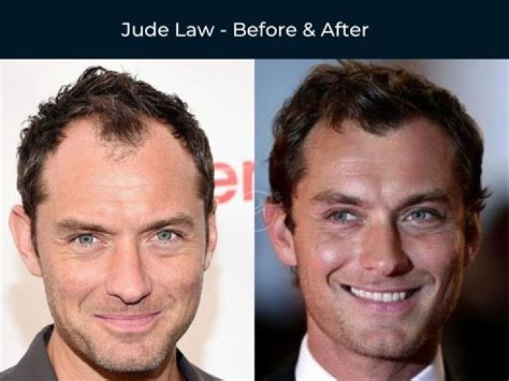 Actor Goes Grey – Before & After Photos – Hollywood Life